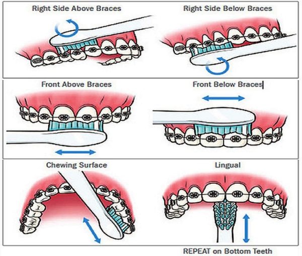 How to Choose an Orthodontist Cook & Gutsche Orthodontics